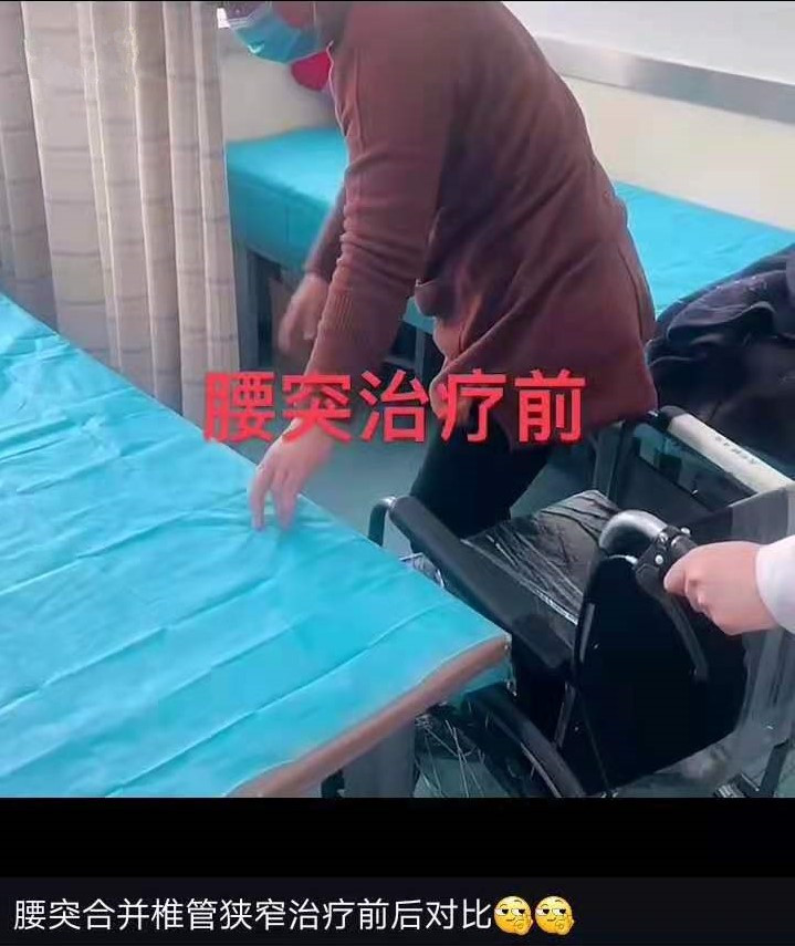 案例三_腰突治疗