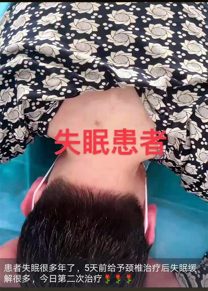 患者失眠很多年，尝试过很多方法都收效甚微；5天前给予颈椎治疗后，失眠缓解大半，患者信任度提升，兴高采烈来做第二次治疗